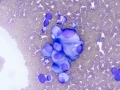 Chemodectoma