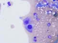 Chemodectoma