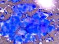 Chemodectoma