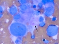 Chemodectoma