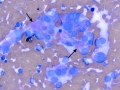 Chemodectoma