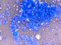 Chemodectoma