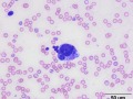 Rubriphagocytosis