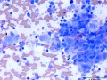 Histiocytic sarcoma (cat)