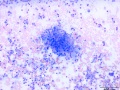 Histiocytic sarcoma (cat)