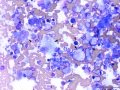 Histiocytic sarcoma (cat)