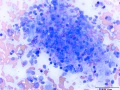 Histiocytic sarcoma (cat)