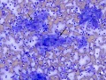 Mycobacteria (DQ, cat)