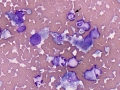 EMH & Anaplasma (dog)
