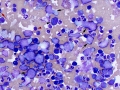 Lymphoma (T cell, dog)