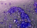 Sarcoma (dog)