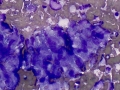 Sarcoma (dog)