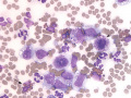 Mast cell tumor (equine)