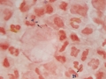 Rhodococcus (equine, gram)