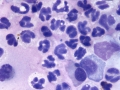 Rhodococcus (equine)