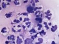 Rhodococcus (equine)