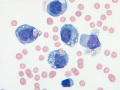 Erythrophagia (equine)