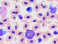 Compilation of cells