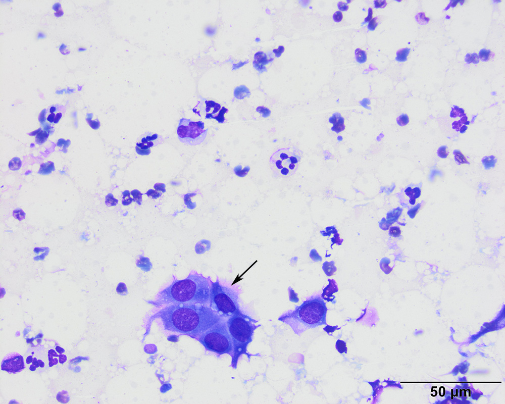 Mesothelial cells (lung, DQ)