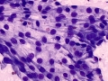 Mesothelial cells (mediastinum)