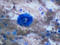 Pulmonary carcinoma (cat)