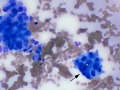 Pulmonary carcinoma (cat)