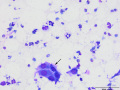 Mesothelial cells (lung, DQ)