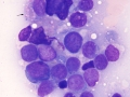 AML (dog, mediastinum)