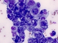 Carcinoma (cat, mediastinum)