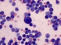 Mast cell tumor (dog, mediastinum)