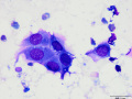 Mesothelial cells (lung, DQ)