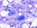 Sarcoma (cat, chest)