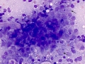 Lymphoma (cat, lung)