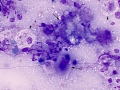 Lymphoma (cat, lung)