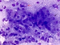 Lymphoma (cat, lung)