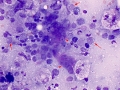 Lymphoma (cat, lung)