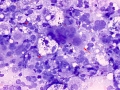 Lymphoma (cat, lung)