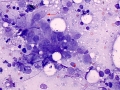 Lymphoma (cat, lung)