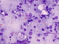 Lymphoma (cat, lung)