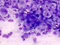 Lymphoma (cat, lung)