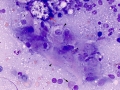 Lymphoma (cat, lung)