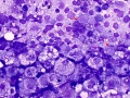 Lymphoma (cat, lung)
