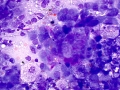 Lymphoma (cat, lung)