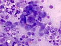 Lymphoma (cat, lung)