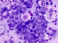 Lymphoma (cat, lung)