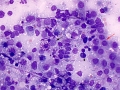 Lymphoma (cat, lung)