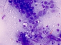 Lymphoma (cat, lung)