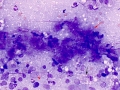 Lymphoma (cat, lung)