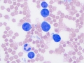 Lymphoma (bovine)