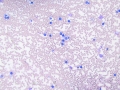Lymphoma (bovine)